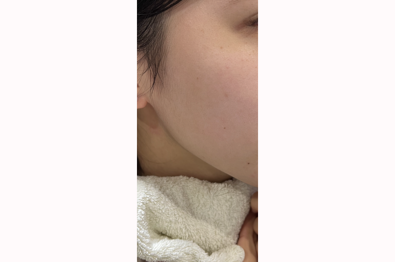 E8C95509-DDCD-4778-A623-AD4EFBA7EF3E